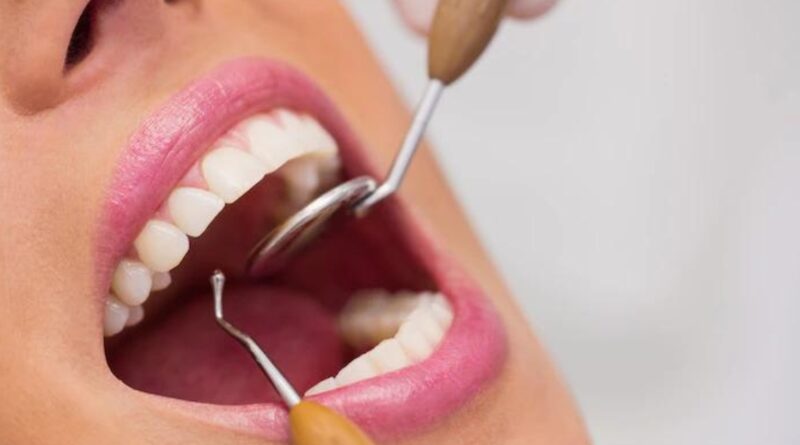 Dentes molares: o que são e quais são os sintomas do seu nascimento